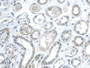 DAB staining on IHC-P; Samples: Human Esophagus)