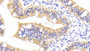 DAB staining on IHC-P; Samples: Human Small intestine Tissue;  Primary Ab: 20μg/ml Mouse Anti-Human RBP2 Antibody Second Ab: 2µg/mL HRP-Linked Caprine Anti-Mouse IgG Polyclonal Antibody 