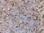 DAB staining on IHC-P; Samples: Human Prostate Tissue