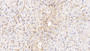 DAB staining on IHC-P; Samples: Human Liver Tissue; Primary Ab: 10ug/ml Mouse Anti-Human ICAM1 Antibody Second Ab: 2µg/mL HRP-Linked Caprine Anti-Mouse IgG Polyclonal Antibody