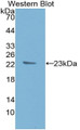 Western Blot; Sample: Recombinant protein.