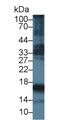 Western Blot; Sample: Rat Uterus lysate; Primary Ab: 5µg/ml Mouse Anti-Human PIIINP Antibody Second Ab: 0.2µg/mL HRP-Linked Caprine Anti-Mouse IgG Polyclonal Antibody