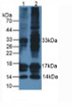 Western Blot; Sample: Lane1: Rat Thyroid Tissue; Lane2: Human SW579 Cells.