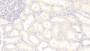 DAB staining on IHC-P; Samples: Human Kidney Tissue;  Primary Ab: 30μg/ml Mouse Anti-Human PCT Antibody Second Ab: 2µg/mL HRP-Linked Caprine Anti-Mouse IgG Polyclonal Antibody 