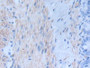 DAB staining on IHC-P; Samples: Rat Intestine Tissue;  Primary Ab: 20µg/ml Mouse Anti-Rat INHbA Anti