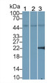 Western Blot; Sample: Lane1: Porcine Cerebrum lysate; Lane2: Rat Liver lysate; Lane3: K562 cell lysate; Primary Ab: 5μg/ml Mouse Anti-Rat PPARg Antibody; Second Ab: 0.2µg/mL HRP-Linked Caprine Anti-Mouse IgG Polyclonal Antibody;