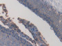 DAB staining on IHC-P; Samples: Rat Testis Tissue; Primary Ab: 30µg/ml Mouse Anti-Rat PPARg Antibody Second Ab: 2µg/mL HRP-Linked Caprine Anti-Mouse IgG Polyclonal Antibody