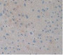 DAB staining on IHC-P; Samples: Human Liver Tissue.