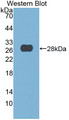 Western Blot; Sample: Recombinant protein.