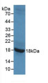 Western Blot; Sample: Recombinant GAD2, Rat.