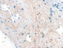 DAB staining on IHC-P; Samples: Human Liver Tissue;  Primary Ab: 30µg/ml Mouse Anti-Human ELN Antibody Second Ab: 2µg/mL HRP-Linked Caprine Anti-Mouse IgG Polyclonal Antibody 