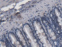 DAB staining on IHC-P; Samples: Rat Colon Tissue; Primary Ab: 20µg/ml Mouse Anti-Multi-species LPS Antibody Second Ab: 2µg/mL HRP-Linked Caprine Anti-Mouse IgG Polyclonal Antibody