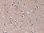 DAB staining on IHC-P; Samples: Human Cerebrum Tissue; Primary Ab: 30µg/ml Mouse Anti-Human ADAM17 Antibody Second Ab: 2µg/mL HRP-Linked Caprine Anti-Mouse IgG Polyclonal Antibody