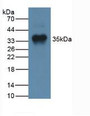 Western Blot; Sample: Human Liver Tissue.