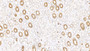 DAB staining on IHC-P; Samples: Human Kidney Tissue;  Primary Ab: 10ug/ml Mouse Anti-Human KRT17 Antibody Second Ab: 2µg/mL HRP-Linked Caprine Anti-Mouse IgG Polyclonal Antibody 