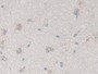 DAB staining on IHC-P; Samples: Human Cerebrum Tissue;  Primary Ab: 30µg/ml Mouse Anti-Human TGFb3 A