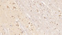DAB staining on IHC-P; Samples: Human Cerebrum Tissue; Primary Ab: 10ug/ml Mouse Anti-Human TNC Antibody Second Ab: 2µg/mL HRP-Linked Caprine Anti-Mouse IgG Polyclonal Antibody