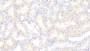 DAB staining on IHC-P; Samples: Human Kidney Tissue;  Primary Ab: 30μg/ml Mouse Anti-Human S100A3 Antibody Second Ab: 2µg/mL HRP-Linked Caprine Anti-Mouse IgG Polyclonal Antibody 