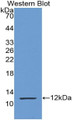 Western Blot; Sample: Recombinant protein.