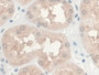 DAB staining on IHC-P; Samples: Human Kidney Tissue; Primary Ab: 30µg/ml Mouse Anti-Human GREM1 Antibody Second Ab: 2µg/mL HRP-Linked Caprine Anti-Mouse IgG Polyclonal Antibody