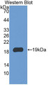 Western Blot; Sample: Recombinant protein.