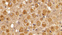 DAB staining on IHC-P; Sample: Rat Spinal cord Tissue; Primary Ab: 10ug/ml Mouse Anti-Rat IBA1 Antibody Second Ab: 2µg/mL HRP-Linked Caprine Anti-Mouse IgG Polyclonal Antibody