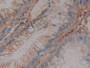 DAB staining on IHC-P; Samples: Human Rectum Tissue; Primary Ab: 30µg/ml Mouse Anti-Human AT Antibody Second Ab: 2µg/mL HRP-Linked Caprine Anti-Mouse IgG Polyclonal Antibody