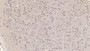 DAB staining on IHC-P; Samples: Human Cerebrum Tissue; Primary Ab: 10µg/ml Mouse Anti-Human SIGLEC10 Antibody Second Ab: 2µg/mL HRP-Linked Caprine Anti-Mouse IgG Polyclonal Antibody