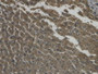 Figure. DAB staining on IHC-P; Samples: Human Liver Tissue.