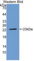 Western Blot;Sample: Recombinant CRYbB2, Rat