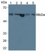 Western Blot; Sample: Human Serum; Lane2: Porcine Liver Tissue; Lane3: Human Liver Tissue; Lane4: Porcine Pancreas Tissue; Lane5: Porcine Kidney Tissue.