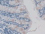 DAB staining on IHC-P; Samples: Mouse Colon Tissue;  Primary Ab: 20µg/ml Mouse Anti-Mouse IL1F9 Antibody Second Ab: 2µg/mL HRP-Linked Caprine Anti-Mouse IgG Polyclonal Antibody 