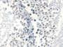 DAB staining on IHC-P; Samples: Rat Testis Tissue;  Primary Ab: 30µg/ml Mouse Anti-Rat AR Antibody S