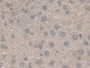 DAB staining on IHC-P; Samples:Mouse Liver Tissue