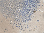 DAB staining on IHC-P; Samples: Mouse Cerebrum Tissue; Primary Ab: 30µg/ml Mouse Anti-Mouse BNP Antibody Second Ab: 2µg/mL HRP-Linked Caprine Anti-Mouse IgG Polyclonal Antibody