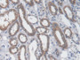 DAB staining on IHC-P; Samples: Human Kidney Tissue;  Primary Ab: 20µg/ml Mouse Anti-Human AST Antib