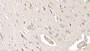 DAB staining on IHC-P; Samples: Human Cerebrum Tissue;  Primary Ab: 40µg/ml Mouse Anti-Human IL19 Antibody Second Ab: 2µg/mL HRP-Linked Caprine Anti-Mouse IgG Polyclonal Antibody 