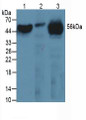 Western Blot; Sample: Lane1: Human Serum; Lane2: Human Liver Tissue; Lane3: Mouse Heart Tissue.