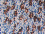 DAB staining on IHC-P; Samples: Rat Stomach Tissue;  Primary Ab: 40µg/ml Mouse Anti-Rat CSTB Antibod