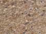 DAB staining on IHC-P; Samples: Human Glioma Tissue; Primary Ab: 20µg/ml Mouse Anti-Human AQP4 Antibody Second Ab: 2µg/mL HRP-Linked Caprine Anti-Mouse IgG Polyclonal Antibody