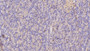 DAB staining on IHC-P; Samples: Human Pancreas Tissue; Primary Ab: 20µg/ml Mouse Anti-Human ISR Antibody Second Ab: 2µg/mL HRP-Linked Caprine Anti-Mouse IgG Polyclonal Antibody