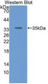 Western Blot;Sample: Recombinant RBP3, Human.