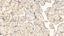 DAB staining on IHC-P; Samples: Human Placenta Tissue; Primary Ab: 20µg/ml Mouse Anti-Human VEGFR2 Antibody Second Ab: 2µg/mL HRP-Linked Caprine Anti-Mouse IgG Polyclonal Antibody