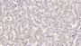 DAB staining on IHC-P; Samples: Human Liver Tissue; Primary Ab: 10µg/ml Mouse Anti-Human IGFBP4 Antibody Second Ab: 2µg/mL HRP-Linked Caprine Anti-Mouse IgG Polyclonal Antibody