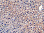 DAB staining on IHC-P; Samples: Rat Liver Tissue;  Primary Ab: 20µg/ml Mouse Anti-Rat CD40L Antibody Second Ab: 2µg/mL HRP-Linked Caprine Anti-Mouse IgG Polyclonal Antibody 