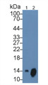 Western Blot; Sample: Lane1: Human Serum; Lane2: Human Leukocyte cell lysate; Primary Ab: 3µg/ml Mouse Anti-Human bTG Antibody; Second Ab: 0.2µg/mL HRP-Linked Caprine Anti-Mouse IgG Polyclonal Antibody;