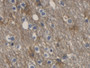 DAB staining on IHC-P; Samples: Human Cerebrum Tissue; Primary Ab: 20µg/ml Mouse Anti-Human AQP4 Antibody Second Ab: 2µg/mL HRP-Linked Caprine Anti-Mouse IgG Polyclonal Antibody