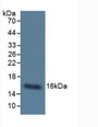 Western Blot; Sample: Human Urine.