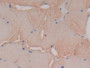 DAB staining on IHC-P; Samples: Rat Skeletal muscle Tissue; Primary Ab: 20µg/ml Mouse Anti-Rat CBG Antibody Second Ab: 2µg/mL HRP-Linked Caprine Anti-Mouse IgG Polyclonal Antibody