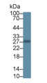 Western Blot; Sample: Rat Placenta lysate; Primary Ab: 2µg/ml Mouse Anti-Human NOG Antibody Second Ab: 0.2µg/mL HRP-Linked Caprine Anti-Mouse IgG Polyclonal Antibody